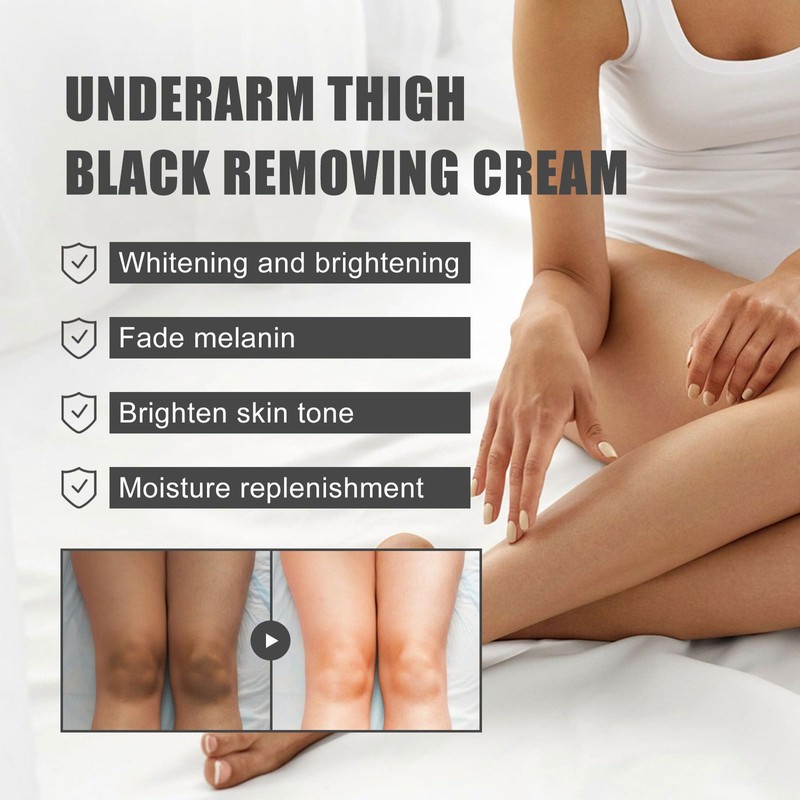 Whitening Cream