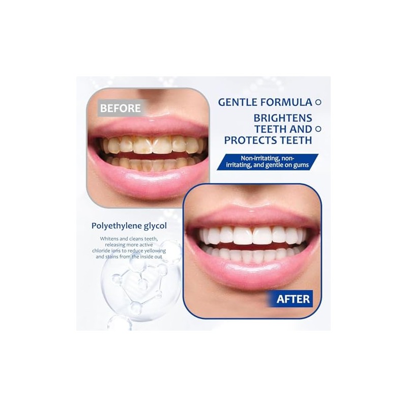 28PCS Tiras Blanqueadoras Dentales 9D, Teeth Whitening strips Anti-Deslizantes, Sabor