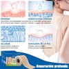 parches de silicona para cicatrices,cinta de silicona para cicatrices, elimina