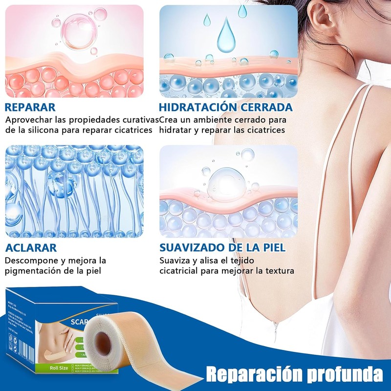 parches de silicona para cicatrices,cinta de silicona para cicatrices, elimina