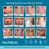 Neutralyze Moderate To Severe Acne Treatment Kit 2.0 - Maximum