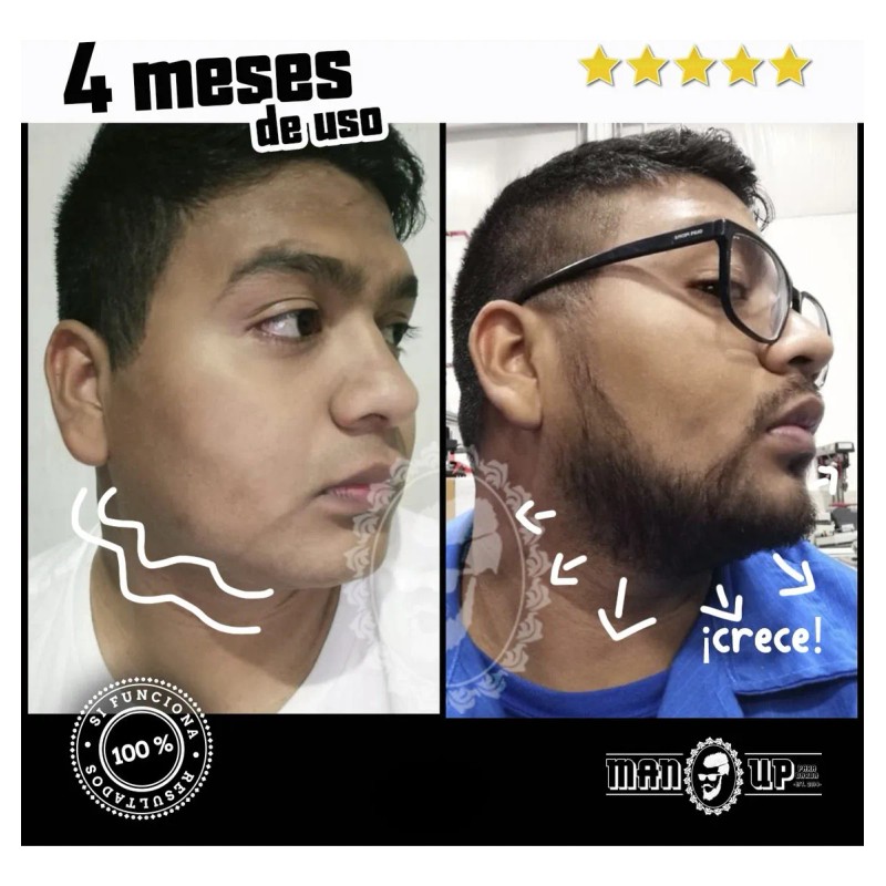 Roll On MANUP Crecimiento de Barba crecimiento de barba y