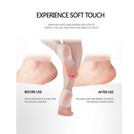 CAREOR 2 Pairs Plantar Fasciitis Therapy Wrap - Plantar Fasciitis Arch Support, Relieve Plantar Fasciitis, Heel Pain, Arch Support, Plantar Fasciitis Sock (White)