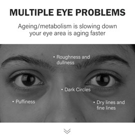 ARCHIDATE Retinol Under Eye Balm Stick, Anti-Aging Retinol Eye Stick for Dark Circles and Puffiness, Smooth Wrinkle Fine Lines, Firm Skin, Non Greasy, Hydrating and Nourish on the Skin Around the Eyes