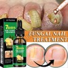 JAYSUING Ginger Nail Care Liquid, Nail Nutrients, Repairs Damaged and