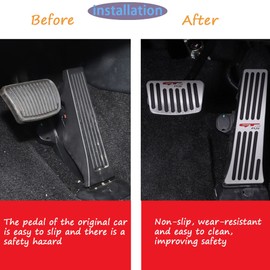 Winkter for Kia K5 2020 2021 2022 2023 2024 2025 Accessories Aluminum Alloy Pedal Covers Anti-Slip Auto No Drilling Aluminum Gas Car Brake Cover (Silver)