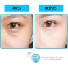60 Parches Ácido Hialurónico Contorno Ojos Y Par 24k Ojeras