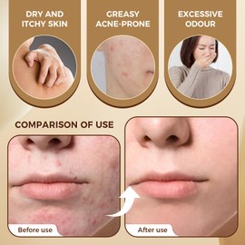 OUKEYA Natural Beef Tallow Soap Bar, Moisturizing, Gentle for Face & Body, Organic Tallow Soap for Dry Skin, Sensitive Skin, Skin Care, Chemical-Free, Cruelty-Free, 2 x 115g