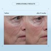 philosophy when hope is not enough facial firming serum -