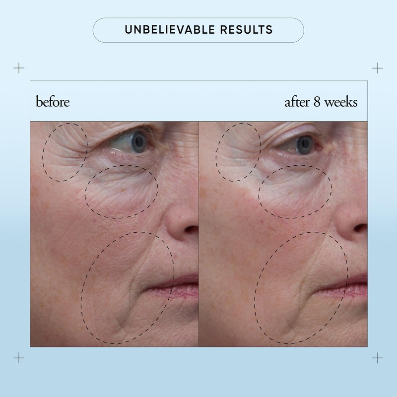 philosophy when hope is not enough facial firming serum -