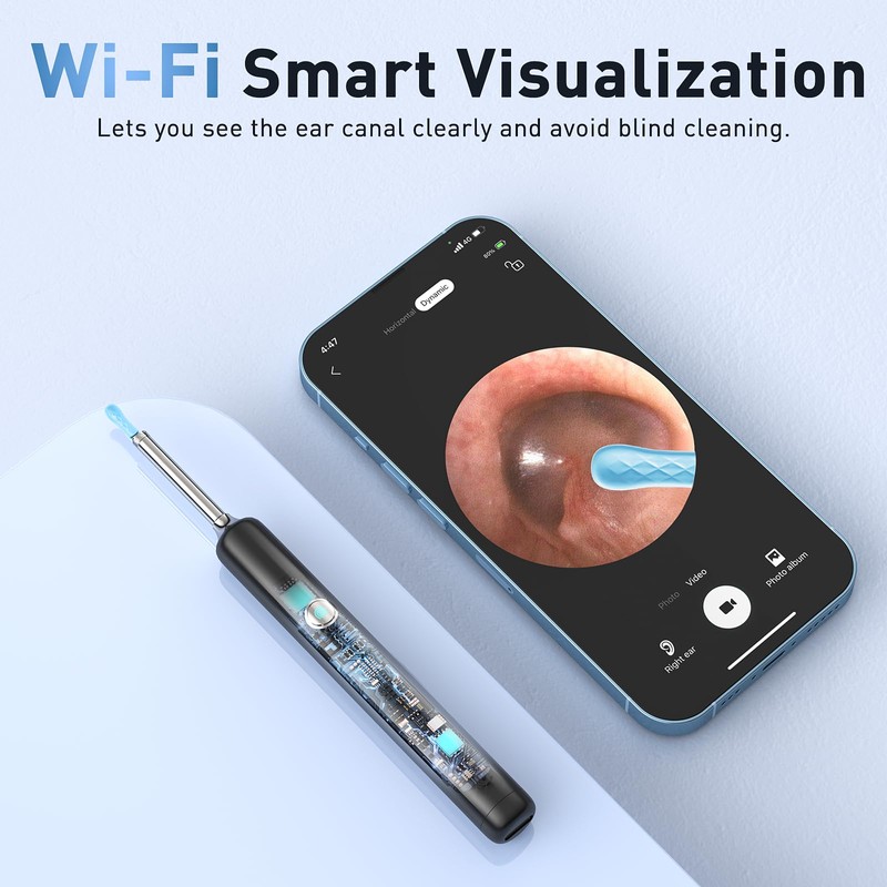 Lebbtl Ear Wax Removal - Electric Ear Irrigation Flushing System,