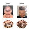 Hair Fibres by Keratech Pro 12ml | Instantly Fuller Hair