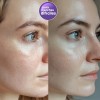Crema Despigmentante Para Manchas, Melasma, Acné Y Paño 50g