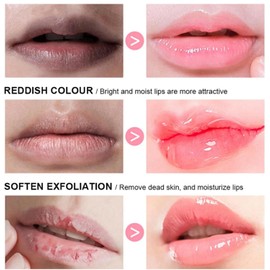 2-Pack Lip Repair Balm Set – Intensive Moisturizing Ointment for Dry, Chapped Lips. Long-Lasting Hydration & Protection with Soothing Lip Cream. Perfect Cracked Treatment in Convenient Tubes