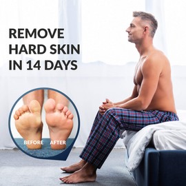Exfoliating foot mask, foot peeling, foot peel mask, foot masks, calluses and calluses foot mask, strong exfoliating foot scrub, dermatologically tested, 2 pairs (up to size 47)