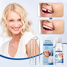 Dental Repair Kit Tooth Repair Kit Permanent Tooth Filling Make Yourself Temporary Dentures DIY for Repair Tooth Gaps Broken Teeth with 4 Tools, 30 g + 5 g