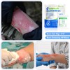 Burn Kit, 4pcs Burn Dressings 4x4”, 8pcs Burn Gel Packets