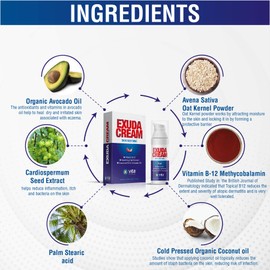 Vita Sciences Exuda Eczema Cream: Soothes Redness, Dryness, Itching & Rashes. Enriched with Vitamin B12 and Prebiotics for Healthier Skin. Use as Full Body Lotion for Dermatitis & Rosacea.