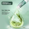 Creme De Tea Tree Oil Para Acne, Espinhas E Pele