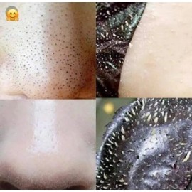 Mascarilla & Jabón Carbón Activado Sheló Nabel Puntos Negros