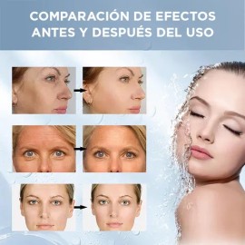Sérum Antiarrugas Acción Intensa 100ml Repara Nutre Firmeza                                                                                           