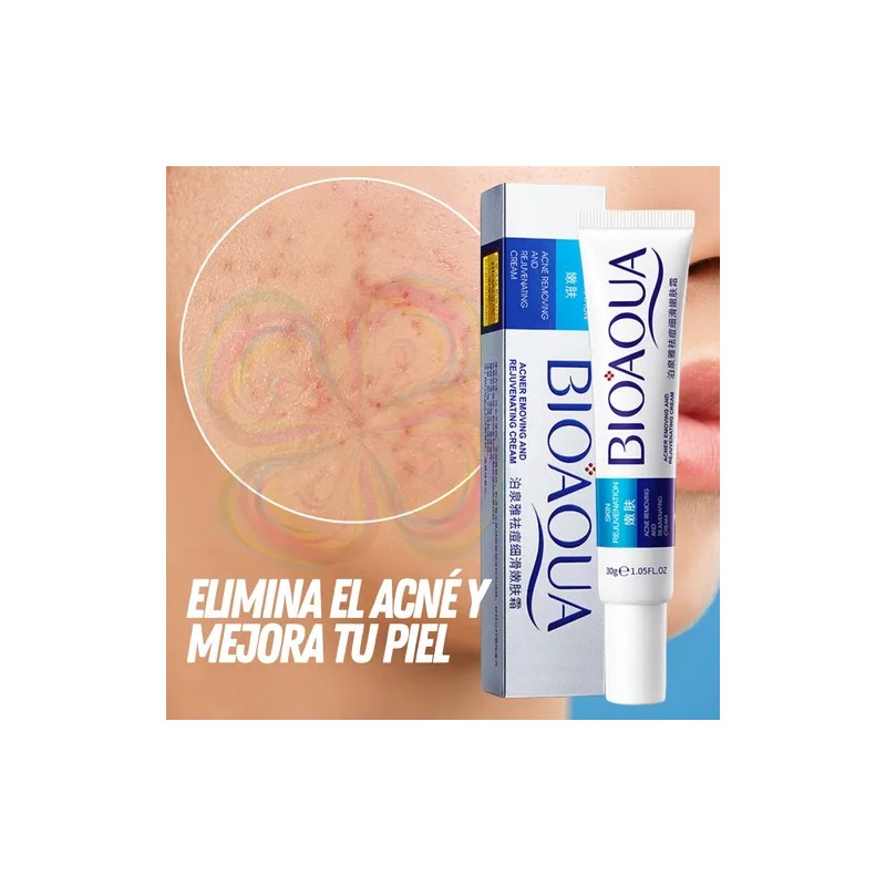 Bioaqua Pure Skin set 4 pzs antiacné, controla grasa en