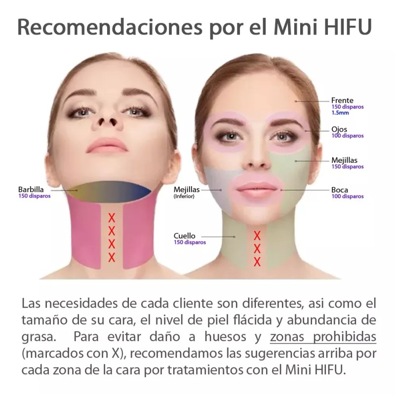 Aqua Aesthetics Mini Hifu V1.0 Radiofrecuencia Ultrasonido Rf Elimina Papada