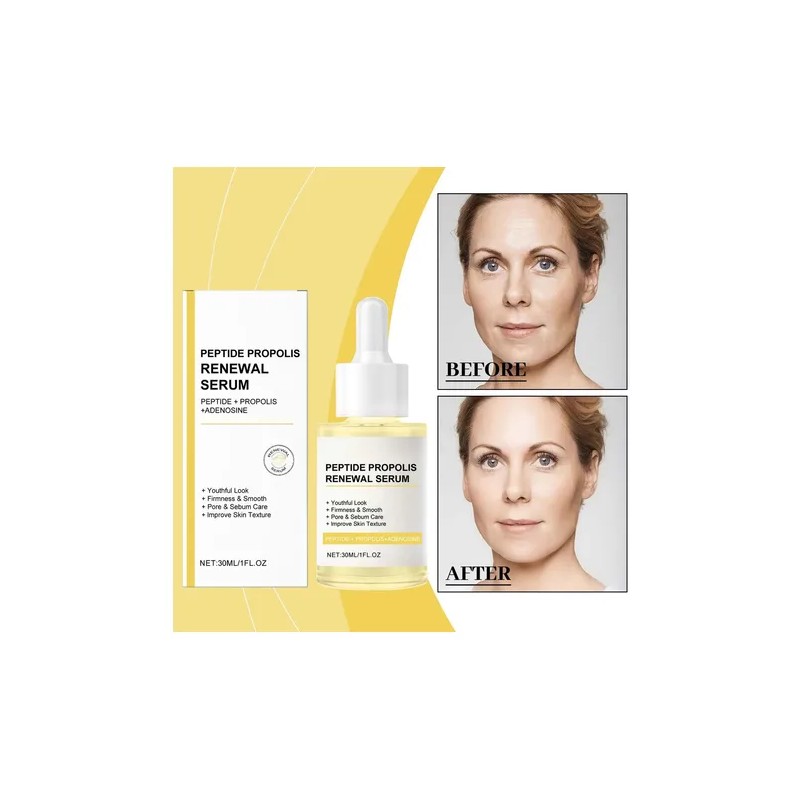 Zlu W Peptide Propolis Suero Pptido Extracto De Propleo Er