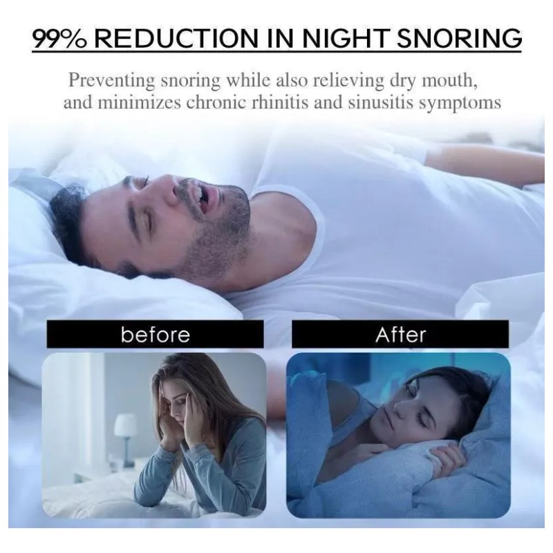 Parche Bucal Para Dormir Para Respirar Por La Boca Contra