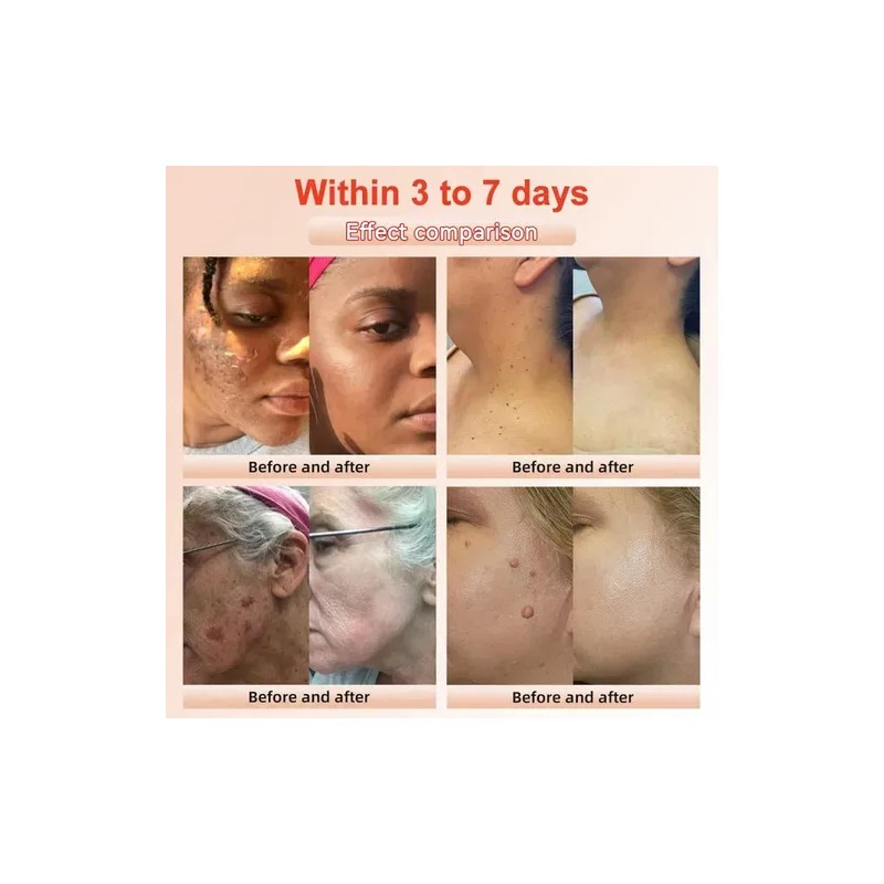 2025 Gel Exfoliante Purificante,exfoliante, Exfoliante Facia