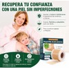 Parches Silicona Cicatrices Rollo Reutilizable Recortable Flexible Cómodo Grado Médico