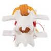 1:1.5 Human Herniated Disc Model Spine Anatomical Medical Study Demonstration