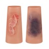 Abrasion and Bruise Wound Care Training Sleeve, Wound Packing Trainer