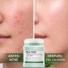 Mascarilla Jelly de Tea Tree para Rostro, Cuidado de Piel