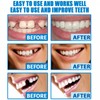 Temporary Tooth Filling Repair Kit - Moldable Tooth Repair Beads