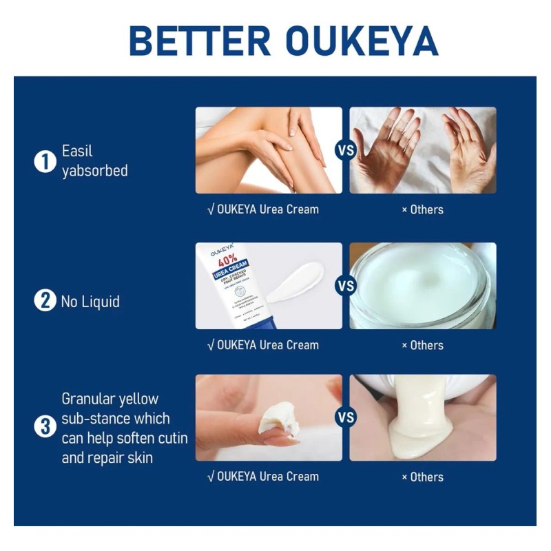Oukeya Crema De Urea 40% Tubo De Urea Crema De