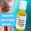 Urban ReLeaf Piercing Bump Shrinking Drops! Keloid Bumps Gentle Effective
