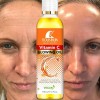 Roushun Vitamin C Moisturizing oil Skin Brightening for Face &