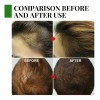 Pelo Aceite De Romero Para El Crecimiento Del Cabello, Suero