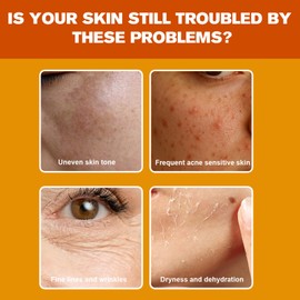 Vitamin C Serum for Face, 15% Vitamin C+E+Ferulic Acid, Potent Anti Aging, Firms, Lifts, Smooths, Skin Care for Dark Spots, Wrinkles,1 fl oz