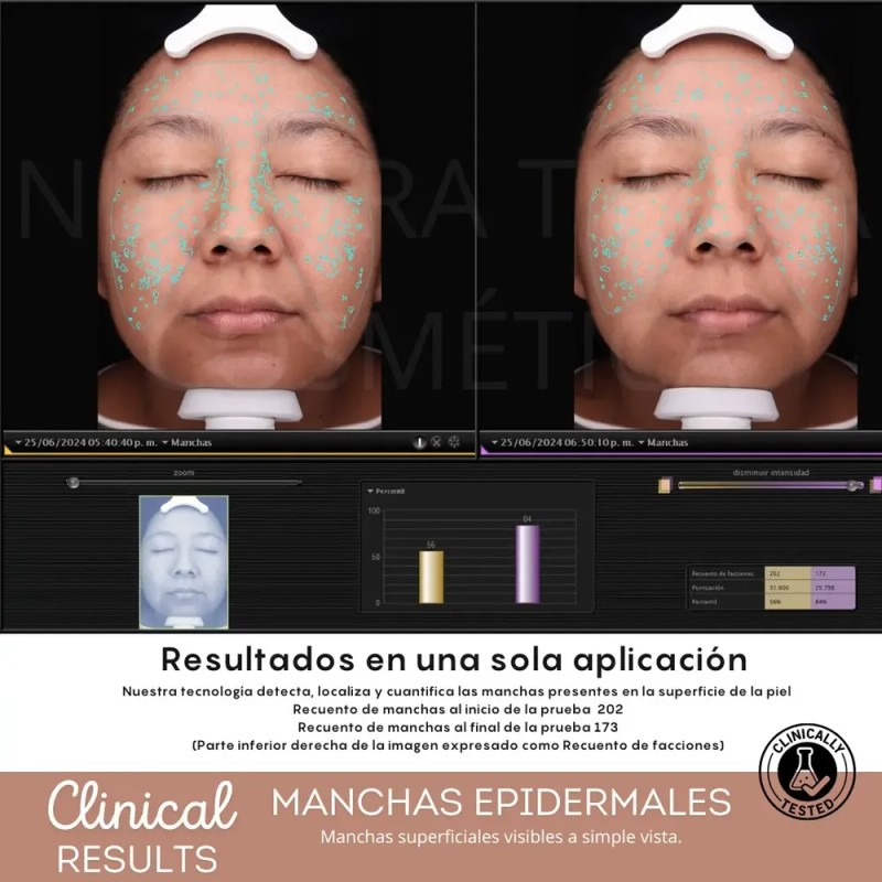 Peeling Enzimático Exfoliante Bbglow Y Faciales 100grs Tipo de piel