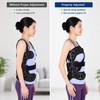 Adjustable Spinal Support Brace for Post-Surgical Recovery – Lightweight Breathable
