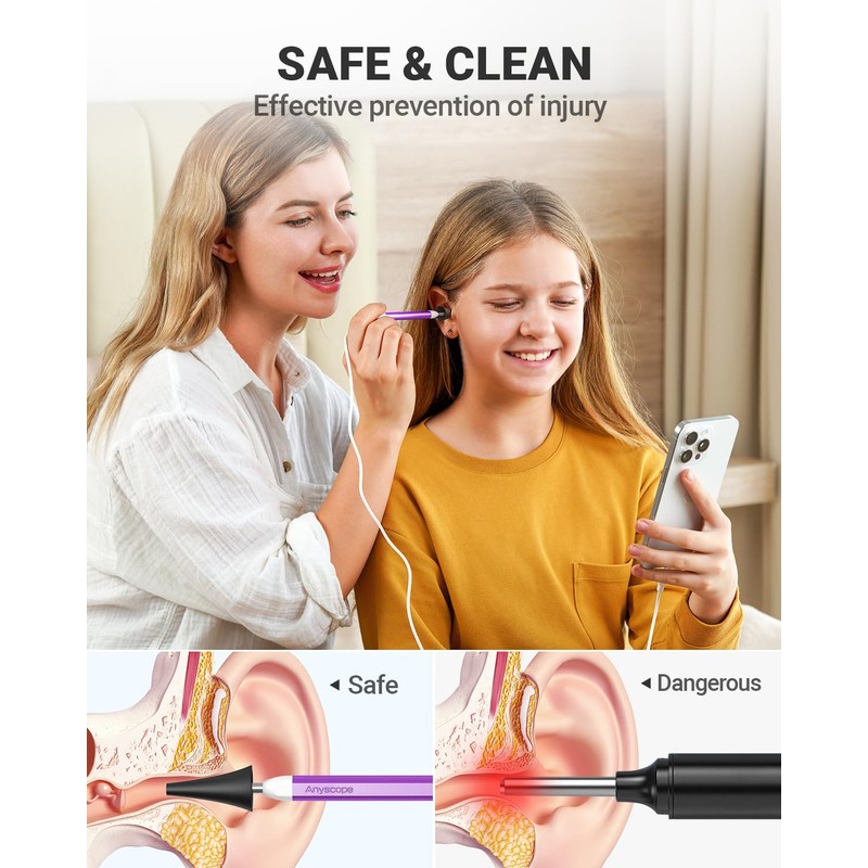 AnyScope AnyScope Digital Otoscope with Gyroscope, HD Ear Camera with