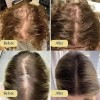 2pcs Aceite Esencial Para Cuidado Del Cabello Veganic Hair