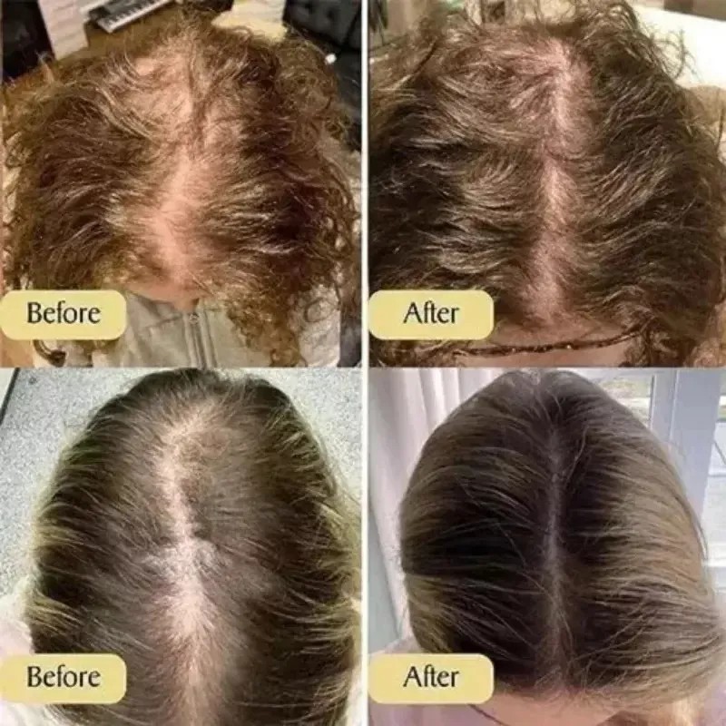 2pcs Aceite Esencial Para Cuidado Del Cabello Veganic Hair