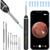 VITCOCO Visual Ear Wax Remover Tool – 1920P HD Camera,