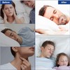 Tiras Antirronquidos para Dormir, Tiras Desechables para La Boca, Cinta