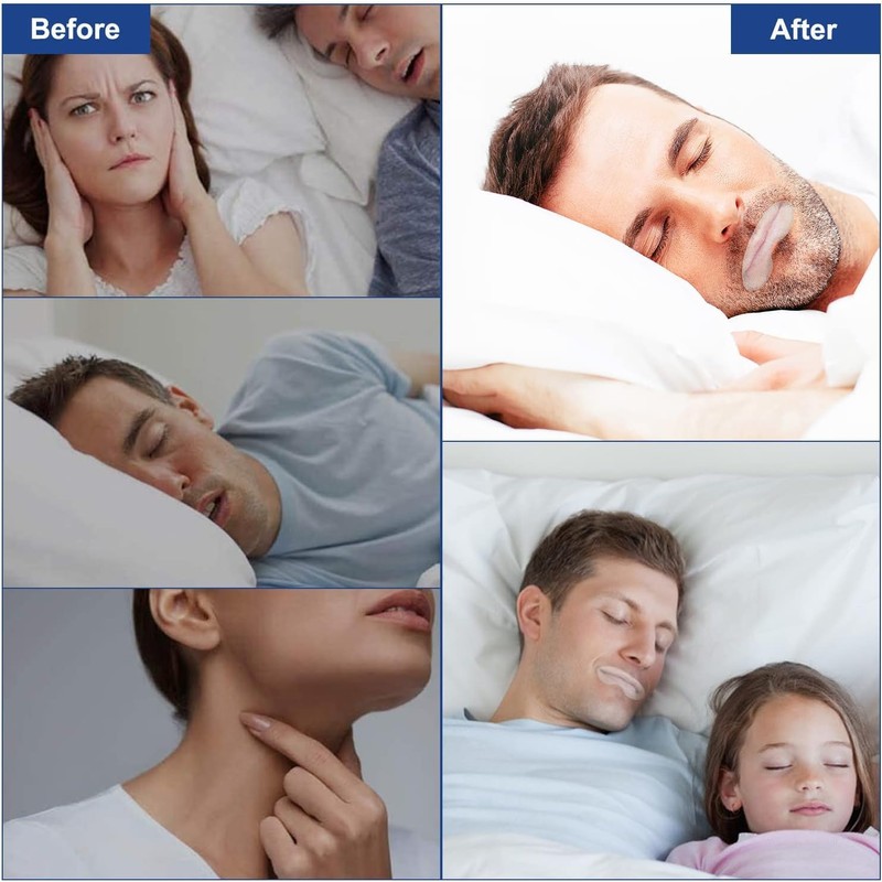 Tiras Antirronquidos para Dormir, Tiras Desechables para La Boca, Cinta
