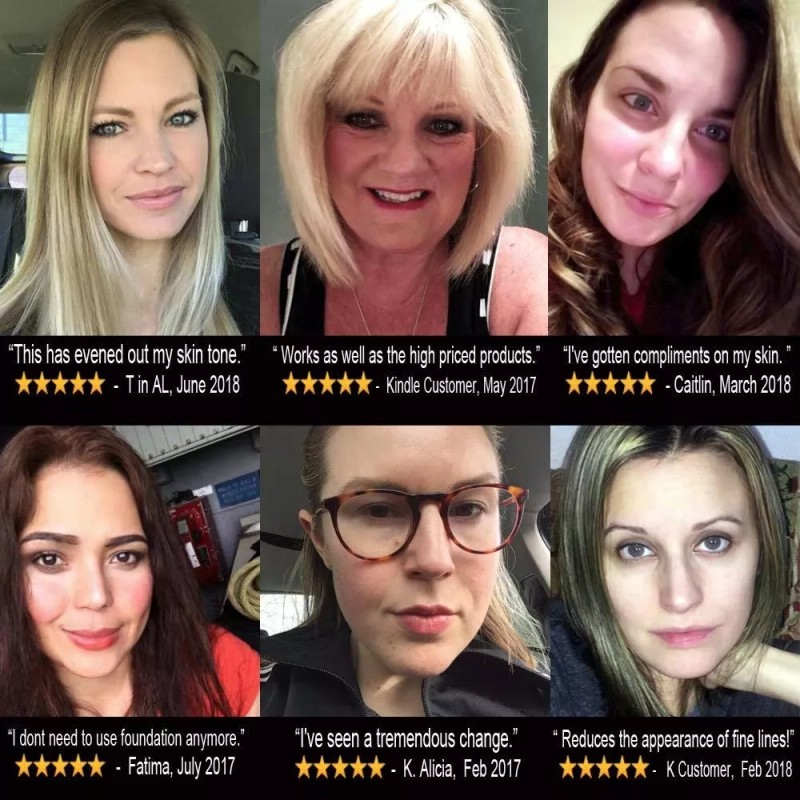 Lilyana Naturals Retinol Crema Hidratante 1,7 Onzas