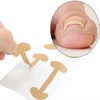 Roycecoqtu 50 Sheets of Ingrown Toenail Protection Band